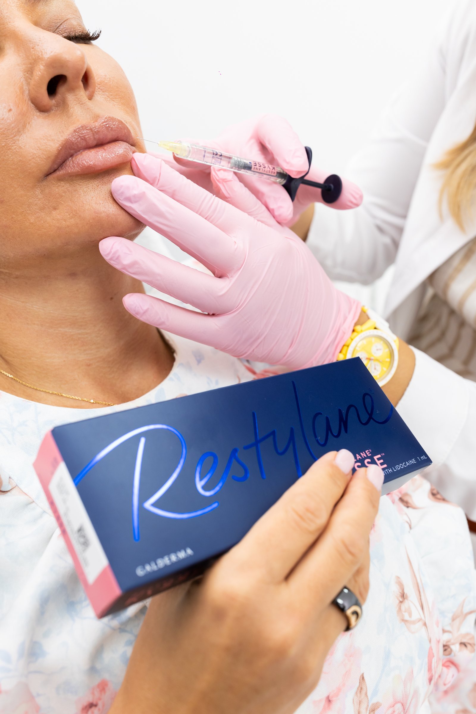 Hijaluronski filer usana — Restylane